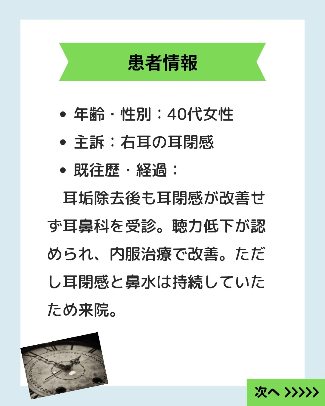 40代の女性のお客様が「右耳の耳閉感」でお悩みでした。
