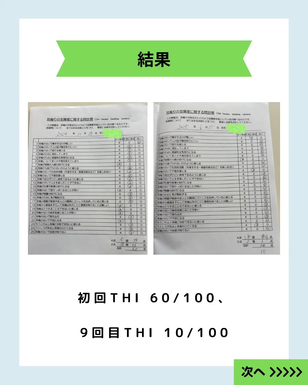 20XX年にお子さんの風邪から始まった中耳炎と、それに続く耳...