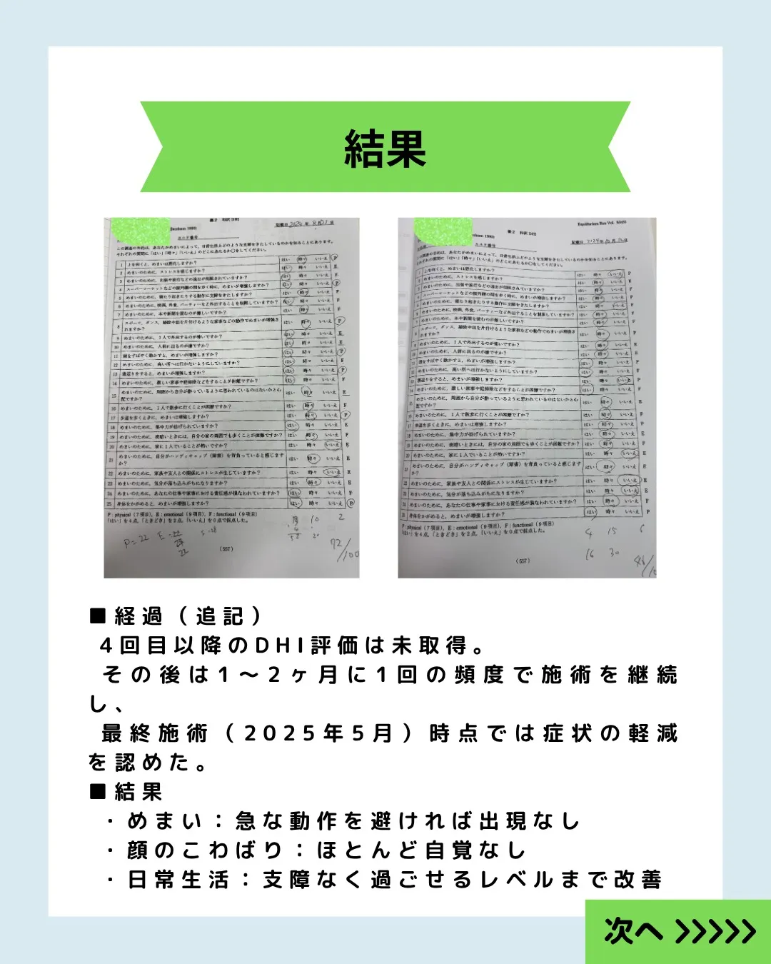 【めまい・顔のこわばりが改善｜ラムゼイハント症候群の症例】