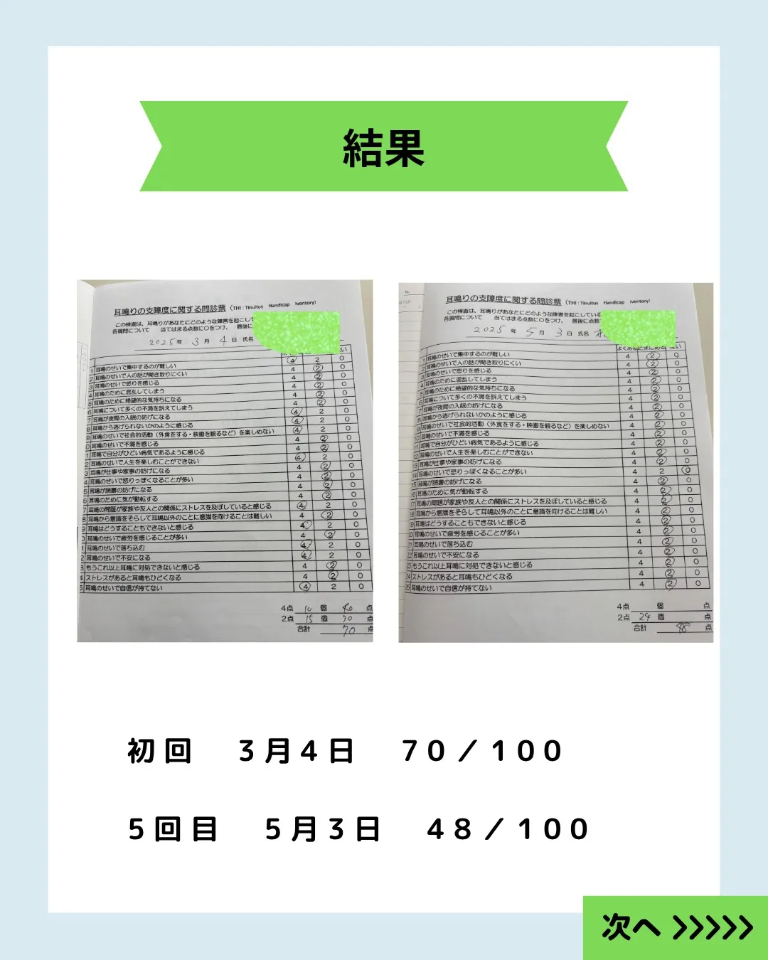 【低音の耳鳴りと不安が軽減｜低音障害型感音難聴の症例】