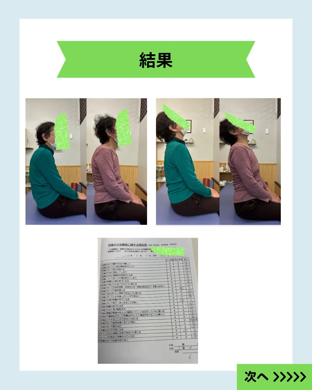 【耳鳴りの原因は姿勢かもしれません】