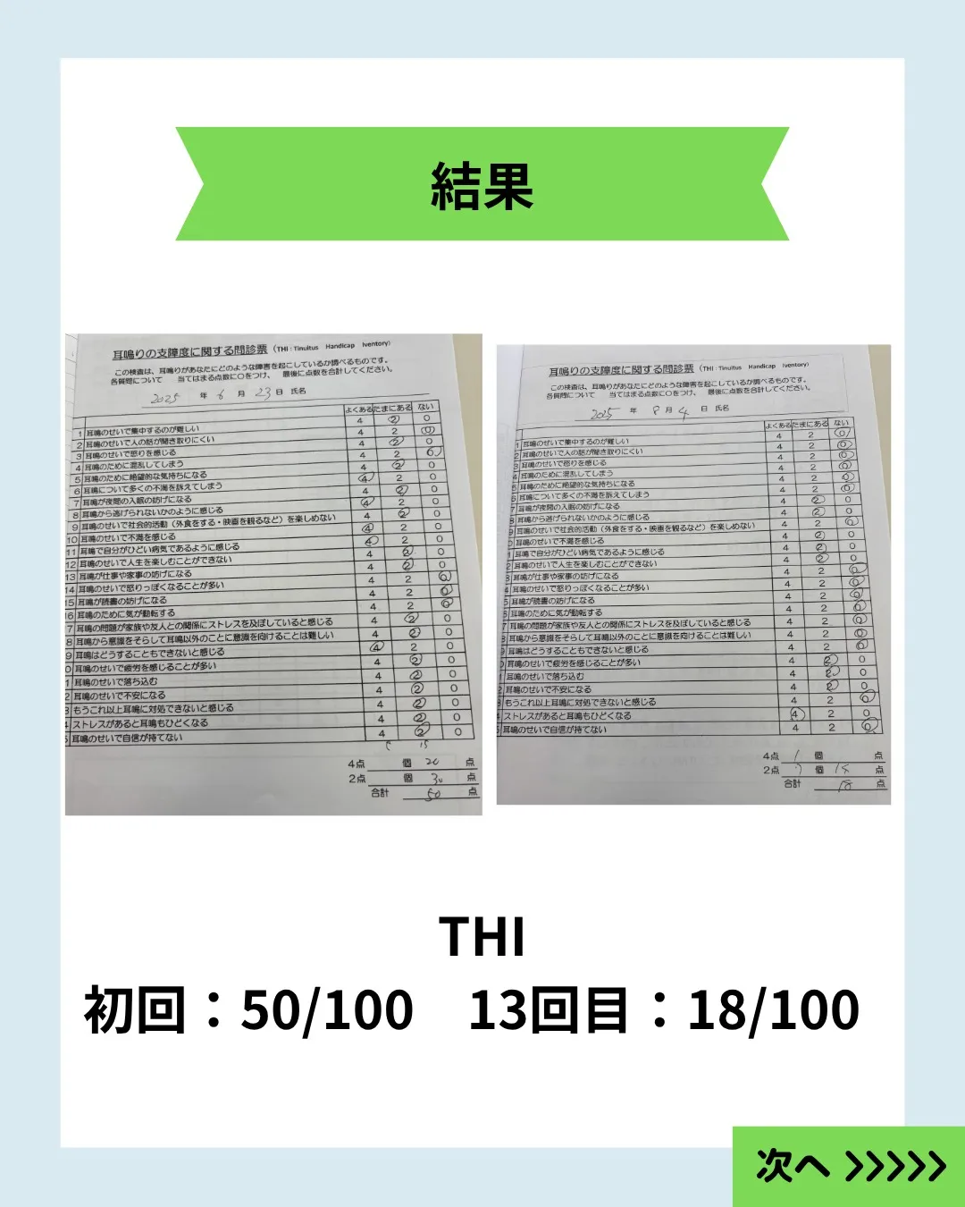 【検査で異常なしと言われた耳鳴り｜60代男性の症例】